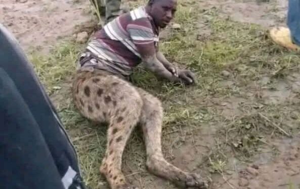 Shocking Incident in South Africa: Man Allegedly Turns into Half-Hyena After Affair with Married Woman