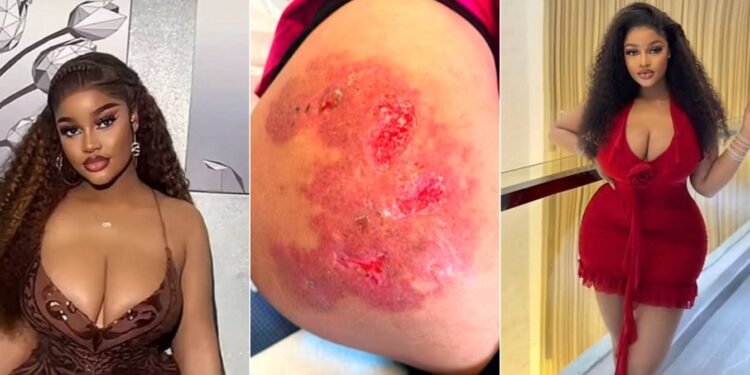 Beautiful Nigerian Lady Dies After Botched BBL Revision 1 NaijaChoice Beautiful Nigerian Lady Dies After Botched BBL Revision