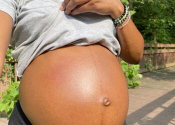 Northern states lead in teenage pregnancy cases in Nigeria