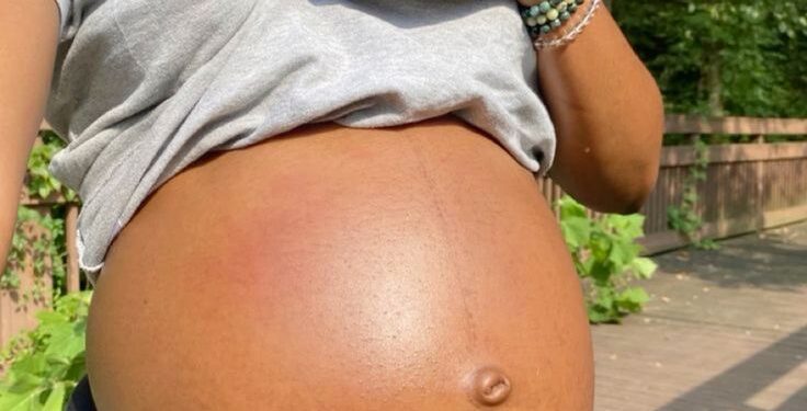 Northern states lead in teenage pregnancy cases in Nigeria 1 NaijaChoice Northern states lead in teenage pregnancy cases in Nigeria