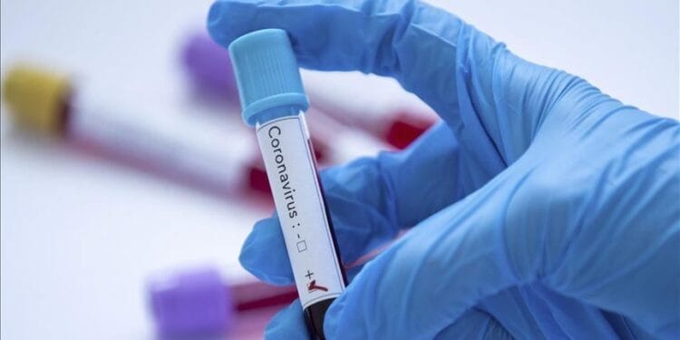 Cross River Confirms Fresh COVID-19 Case, Chinese Victim Hospitalised