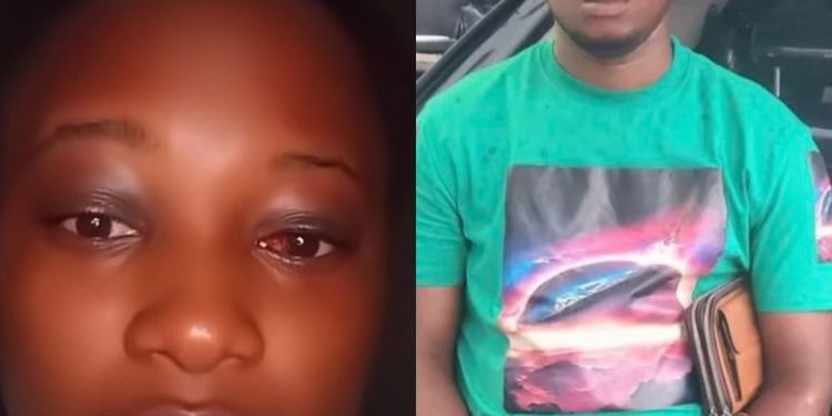 Lady Narrates Horrific Ordeal After Meeting Man on TikTok Who Allegedly Raped and Beat Her 1 NaijaChoice Lady Narrates Horrific Ordeal After Meeting Man on TikTok Who Allegedly Raped and Beat Her