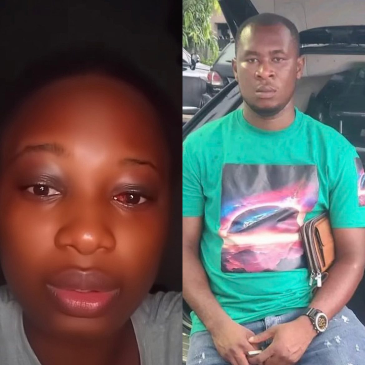 Lady Narrates Horrific Ordeal After Meeting Man on TikTok Who Allegedly Raped and Beat Her