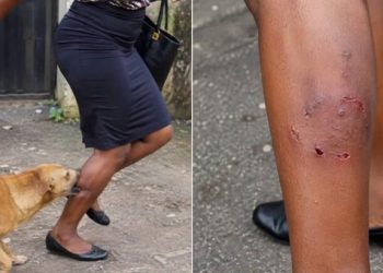 Man Seeks Help After Neighbour’s Dog Allegedly Bites Wife