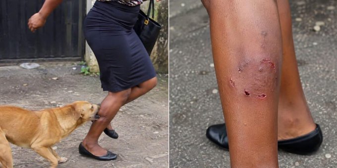 Man Seeks Help After Neighbour’s Dog Allegedly Bites Wife